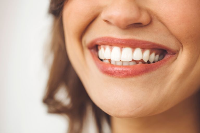 Carillas dentales, la solución a los diastemas