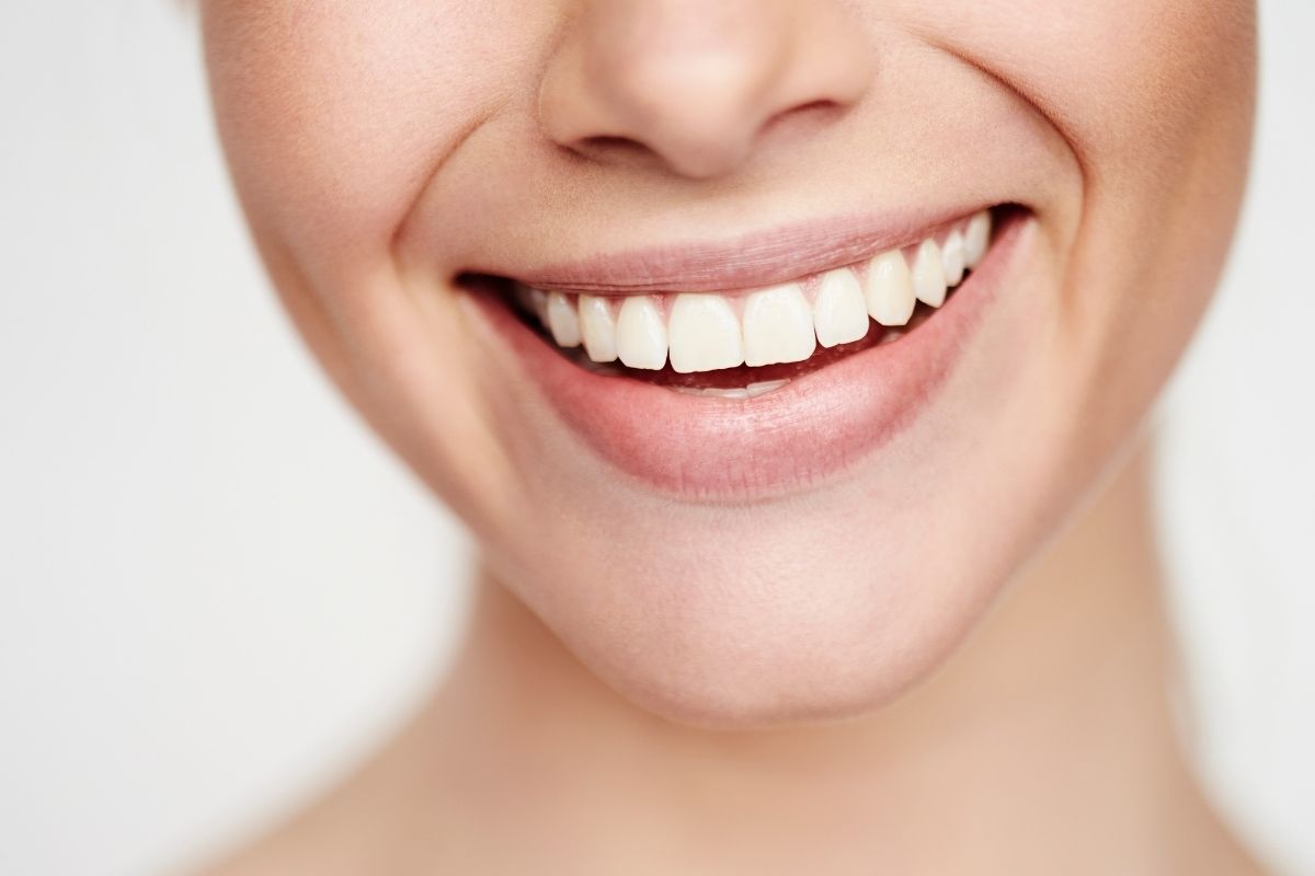 Gingivectomía